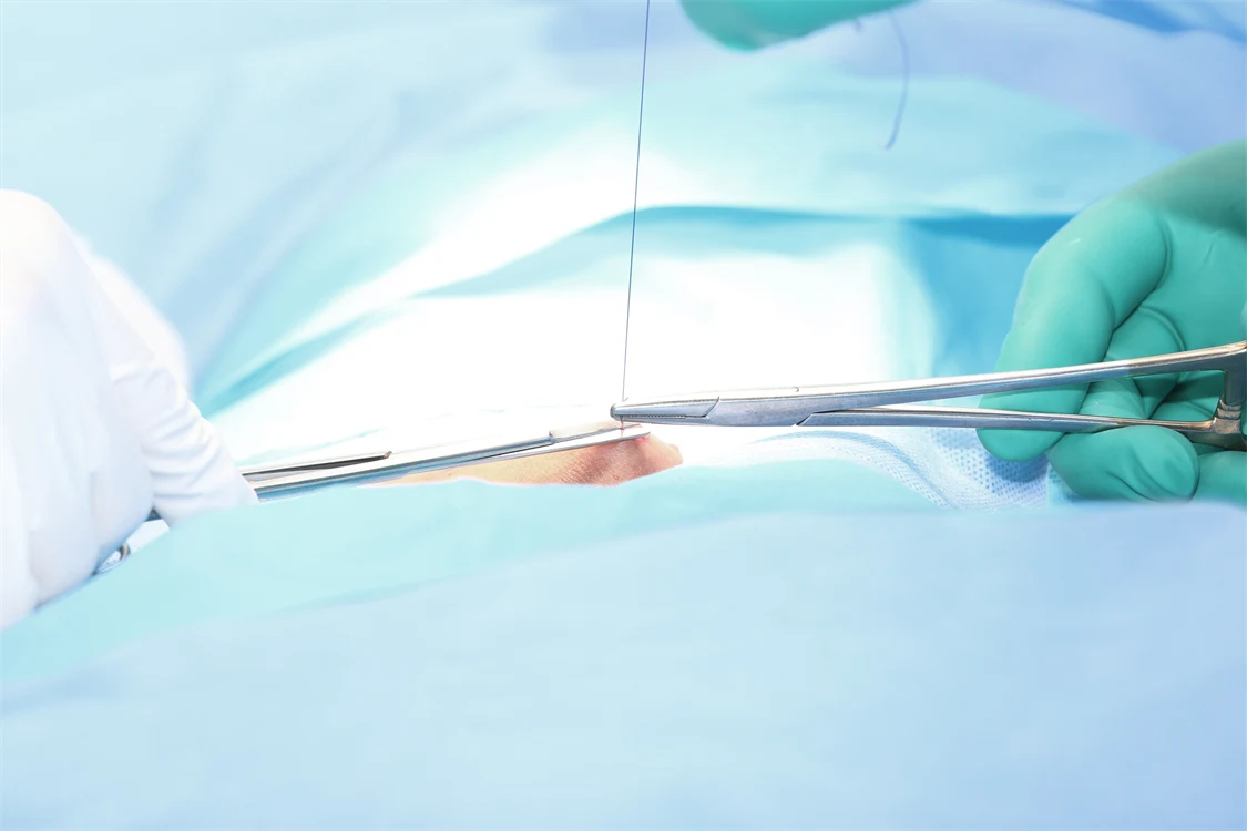 ETO-sterilized surgical sutures